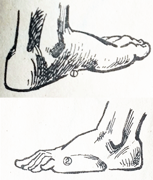 艺用解剖教程：脚的骨骼结构及比例